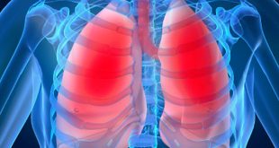 Eficaz para combatir el enfisema pulmonar…